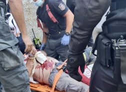 *حيفا: تخليص عامل بعد إصابته بحادث عمل*