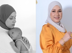 السيرة الذاتية لأخصائية التصوير التشخيصي الطبي فاطمة خضر